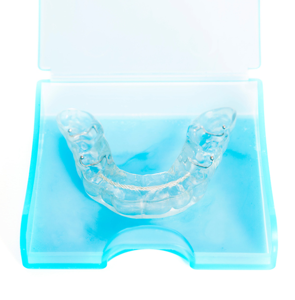All You Need to Know About Oral Appliance Therapy